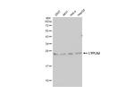 LYPLA2 Antibody in Western Blot (WB)