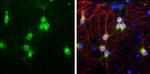 NGFR Antibody in Immunocytochemistry (ICC/IF)