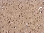 NGFR Antibody in Immunohistochemistry (Paraffin) (IHC (P))