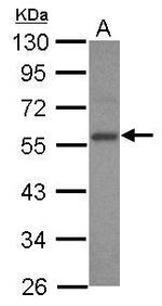 E2F3 Antibody in Western Blot (WB)