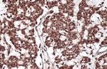 RelB Antibody in Immunohistochemistry (Paraffin) (IHC (P))