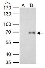 RelB Antibody in Immunoprecipitation (IP)