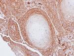 BAG3 Antibody in Immunohistochemistry (Paraffin) (IHC (P))