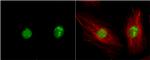 ZIPK Antibody in Immunocytochemistry (ICC/IF)