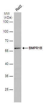 CDw293 Antibody in Western Blot (WB)