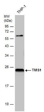 PYCARD Antibody in Western Blot (WB)