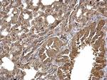 DVL3 Antibody in Immunohistochemistry (Paraffin) (IHC (P))