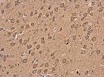 GABBR1 Antibody in Immunohistochemistry (Paraffin) (IHC (P))