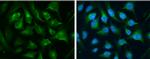 Transferrin Receptor Antibody in Immunocytochemistry (ICC/IF)