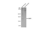 ABCB11 Antibody in Western Blot (WB)