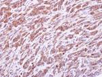 PRPS1 Antibody in Immunohistochemistry (Paraffin) (IHC (P))