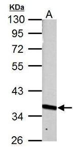 PRPS1 Antibody in Western Blot (WB)