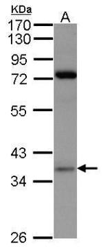 PRPS1 Antibody in Western Blot (WB)