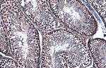 TOP2B Antibody in Immunohistochemistry (Paraffin) (IHC (P))