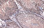 TOP2B Antibody in Immunohistochemistry (Paraffin) (IHC (P))