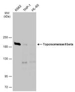 TOP2B Antibody in Western Blot (WB)