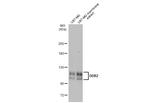 DDR2 Antibody in Western Blot (WB)