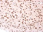 BTRC Antibody in Immunohistochemistry (Paraffin) (IHC (P))