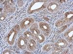 MCCC2 Antibody in Immunohistochemistry (Paraffin) (IHC (P))