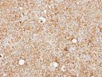 MCCC2 Antibody in Immunohistochemistry (Paraffin) (IHC (P))