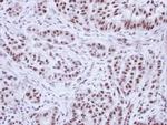 WTAP Antibody in Immunohistochemistry (Paraffin) (IHC (P))