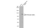 IL10RA Antibody in Western Blot (WB)