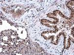 DCK Antibody in Immunohistochemistry (Paraffin) (IHC (P))