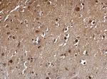 DCK Antibody in Immunohistochemistry (Paraffin) (IHC (P))