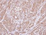 HSD3B2 Antibody in Immunohistochemistry (Paraffin) (IHC (P))