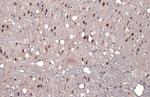 AF9 Antibody in Immunohistochemistry (Paraffin) (IHC (P))