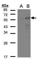 EGR2 Antibody in Western Blot (WB)