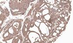 MMP12 Antibody in Immunohistochemistry (Paraffin) (IHC (P))