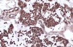 p53 Antibody in Immunohistochemistry (Paraffin) (IHC (P))