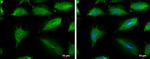 Aconitase 1 Antibody in Immunocytochemistry (ICC/IF)