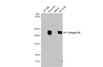 Collagen III Antibody in Western Blot (WB)