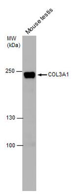 Collagen III Antibody in Western Blot (WB)