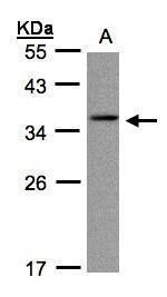 CRYGC Antibody in Western Blot (WB)