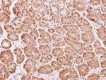 DAK Antibody in Immunohistochemistry (Paraffin) (IHC (P))