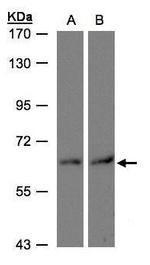 DAK Antibody in Western Blot (WB)