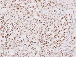 NRF1 Antibody in Immunohistochemistry (Paraffin) (IHC (P))