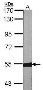 MUTYH Antibody in Western Blot (WB)