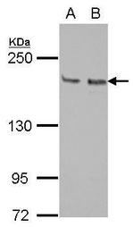 KIF14 Antibody in Western Blot (WB)