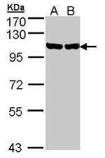 GRP94 Antibody in Western Blot (WB)