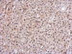 TrxR1 Antibody in Immunohistochemistry (Paraffin) (IHC (P))