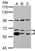 TrxR1 Antibody in Western Blot (WB)