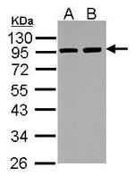 alpha Actinin 3 Antibody in Western Blot (WB)