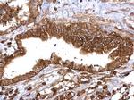 Thymidylate Synthase Antibody in Immunohistochemistry (Paraffin) (IHC (P))