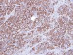 alpha Actinin 1 Antibody in Immunohistochemistry (Paraffin) (IHC (P))