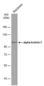 alpha Actinin 1 Antibody in Western Blot (WB)