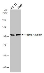 alpha Actinin 1 Antibody in Western Blot (WB)